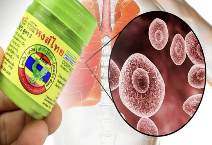 免疫力低族群注意　草本吸入劑恐帶菌危害呼吸道