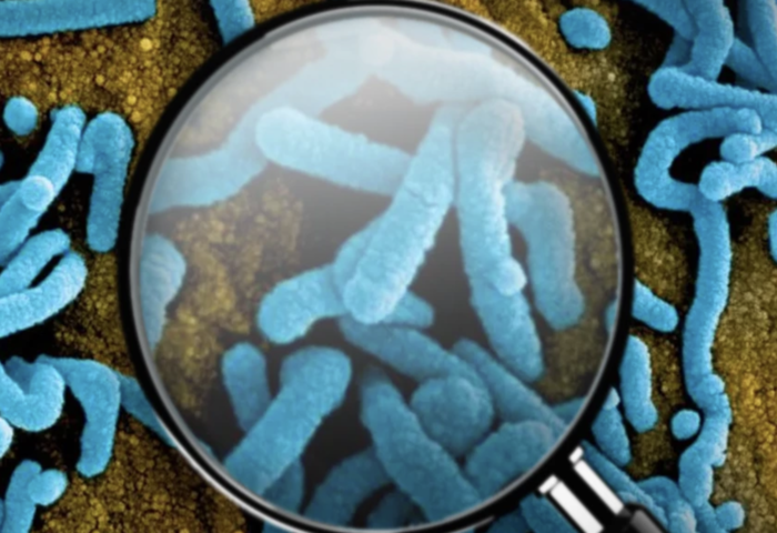 衣索比亞爆馬爾堡疫情　泰國加強入境檢疫