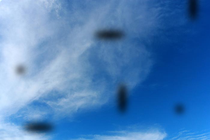 眼前黑點勿忽視　恐為視網膜病變