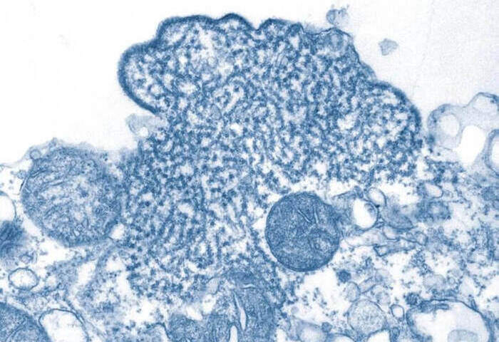 立百病毒列第5類法定傳染病　台灣暫無確診個案