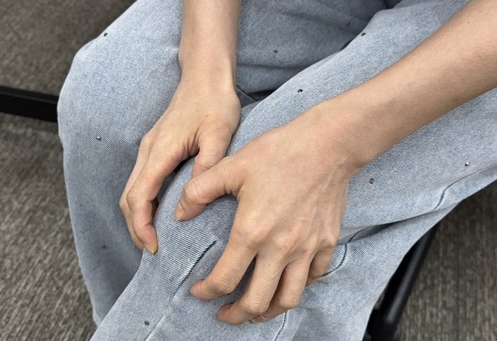 醫示警運動過度與久坐肥胖　膝關節退化年輕化